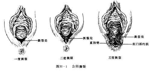 脑挫裂伤是几级伤残 阴道裂伤 阴道裂伤是怎么回事