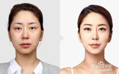 专业整型眼部机构 专业整型眼部机构 整型部位中眼部最受欢迎