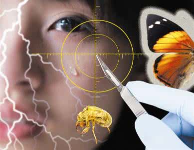 不能风险代理的案件 远离案件风险 10个远离整形风险的忠告