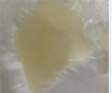 正常的尿液是什么颜色 正常的精液是什么颜色的呢