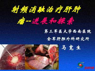 朴炳奎看肿瘤怎么样 肿瘤名家朴炳奎治疗肝癌的独家经验，与您共分享