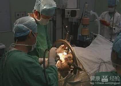 脑瘤手术后能活多久 脑瘤手术后能活多久 脑瘤手术后应注意什么