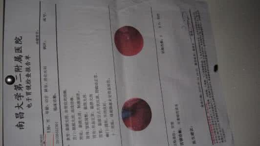 胆囊炎能治愈吗 奇方2则治愈胆囊炎文档