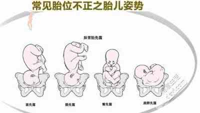 三次剖腹产的后果 剖腹产最多能剖几次