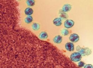 毛驴县令之歪打正着 歪打正着 抗癌药或可为HIV治疗带来希望