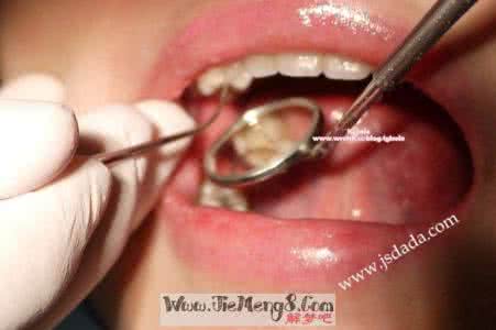 梦见牙齿碎掉吐出来 梦见牙齿碎了并吐出来 梦见牙齿掉了又长出来