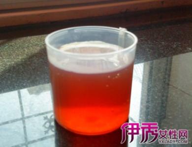 无痛性肉眼血尿 无痛性肉眼血尿 肉眼血尿 尿液可见的含血是什么原因