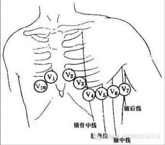 心电图机的使用 如何正确的操作心电图机?