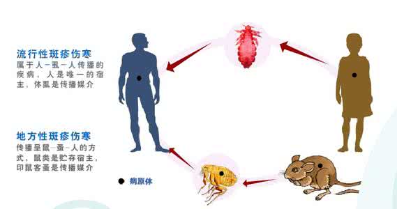 流行性斑疹伤寒 斑疹伤寒（流行性）