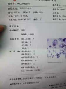 非典型鳞状上皮细胞 非典型鳞状细胞 非典型鳞状上皮细胞 对于它的定义是什么