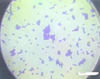 人葡萄球菌是什么 金黄色葡萄球菌 什么是金黄色葡萄球菌