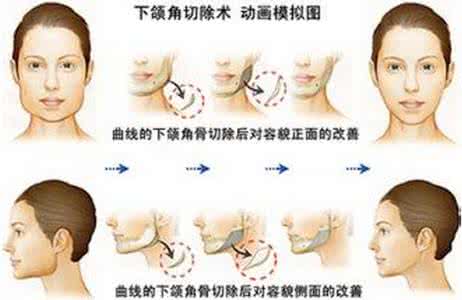 堺雅人对中国的看法 对整形的看法 国人对整形有哪些看法