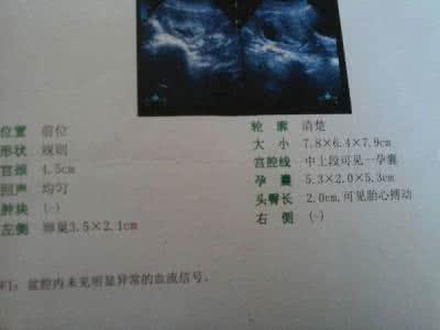 怀孕60天孕囊大小 怀孕60天孕囊大小 怀孕60天孕囊大小怎样