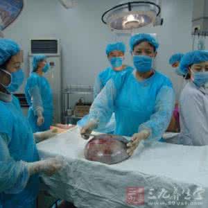 女子腹部长75斤大肿瘤 女子腹部长8.4公斤肿瘤将两个肾挤到同一侧