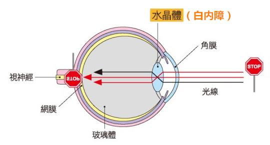 中学生近视眼恢复锻炼 引起中学生近视眼的4大要素