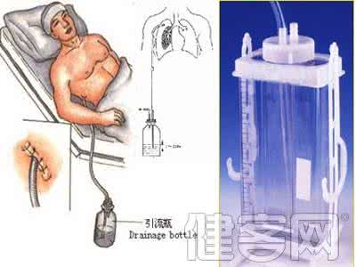 肺癌手术后注意事项 肺癌手术后 肺癌术后的注意事项有哪些