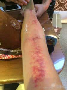 喝奶茶心脏不舒服 喝奶茶心脏不舒服 奶茶易“谋杀”女性心脏