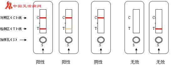 艾滋病检测试纸怎么用 艾滋病检测试纸 怎么检测艾滋病