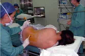 剖腹产过程中会不会疼 剖腹产疼吗?