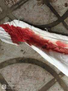 如何做自然催产运动 打催生针后多久生