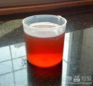 输尿管结石 血尿 国宝秘方：急性输尿管感染血尿一剂断根黄柏汤