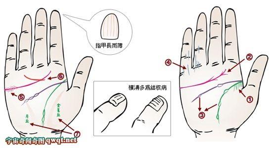 通过手相看疾病 图解24种手相揭示疾病征兆 养生必知(组图26P)