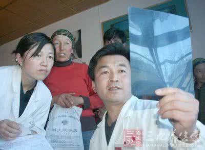 红斑狼疮患者重大喜讯 美丽女孩不幸患上红斑狼疮