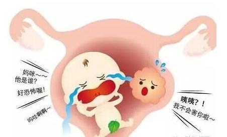 良性子宫肌瘤 子宫肌瘤 良性子宫肌瘤