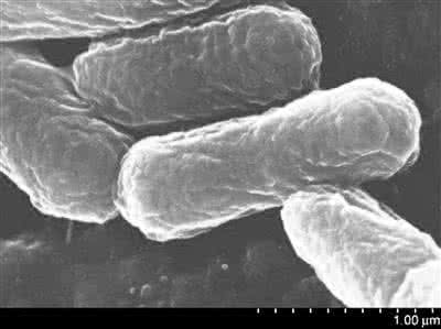 细菌溶解产物胶囊价格 “细菌胶囊”或成新型疫苗输送工具