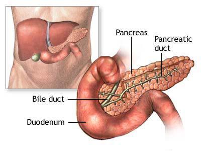 胰腺癌治疗 胰腺癌 胰腺癌治疗