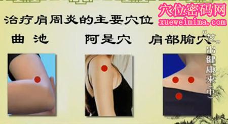 艾灸治疗肩周炎 艾灸治肩周炎,一个穴位就搞定!