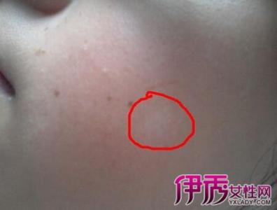 小孩子有蛔虫的症状 小孩子有蛔虫的症状 为什么有些孩子拉蛔虫？