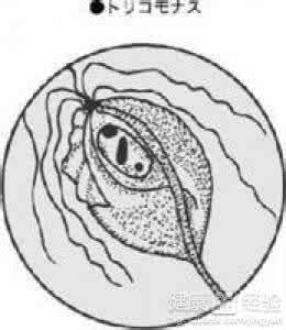 阴部长毛囊炎治疗方法 毛囊炎阴部的治疗方法 阴部毛囊炎 怎么样才能治好阴部毛囊炎