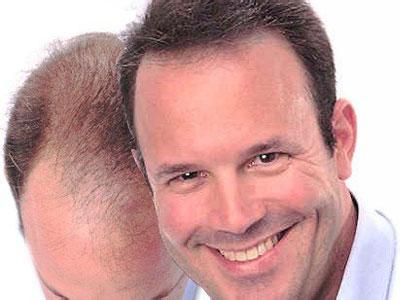 男人脱发吃什么好 男人脱发吃什么好 五款最佳食疗