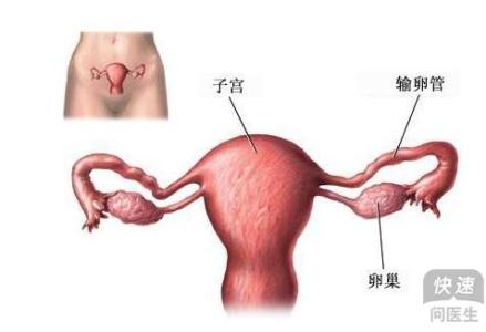 治疗输卵管通而不畅 输卵管通而不畅怎么办 正确治疗输卵管通而不畅