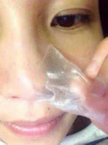 螨虫过敏症状图片 脸上有螨虫的四大症状,看看你有没有中招!