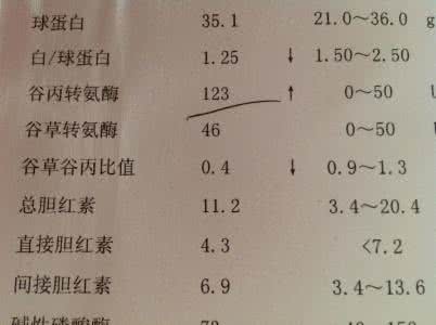 谷草转氨酶偏高吃什么 谷草转氨酶高 谷草转氨酶高有什么症状