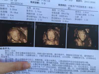 做大排畸的最佳时间 大排畸怎么做