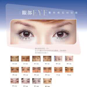 著名眼部整形专家 中国眼部整形专家 专家解析眼部整形的常见问题