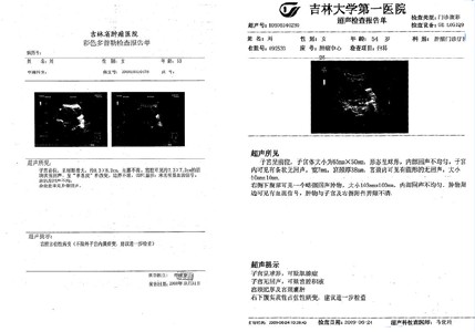 中医治疗胰腺癌肝转移 排瘤疗法已成中医治疗晚期转移癌的最佳方案_瞭望时讯