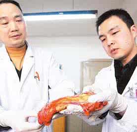 脂肪瘤最新治疗方法 治脂肪瘤妙方