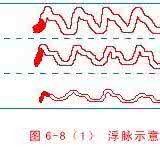 沈金鳌医学全书 脉象统类