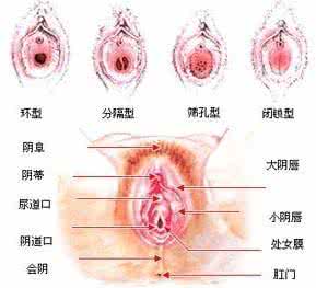 外阴上皮内非瘤样病变 外阴白色病变挂什么科 外阴白色病变的护理