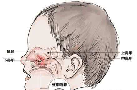 劳累过度的症状 劳累过度 肾脏的隐形杀手