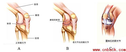 膝关节专科检查 膝关节疾病检查流程