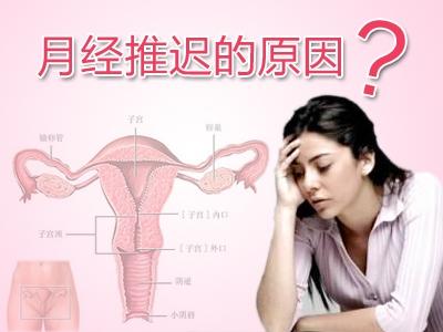女性月经推迟原因 女性月经推迟正常吗及原因