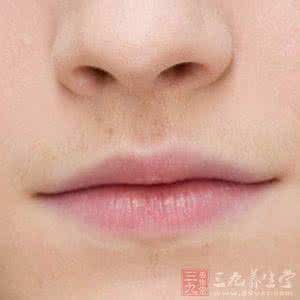 嘴唇疾病 嘴唇传达的疾病信号你注意了吗