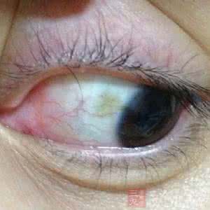 过滤蓝光眼镜 蓝光过滤眼镜没有那么神 蓝光对眼睛有什么危害