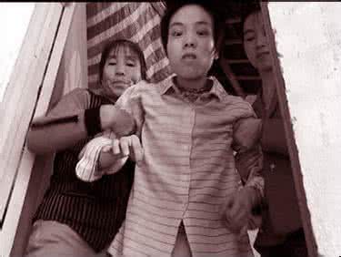 治腱鞘炎的三个小偏方 小舞蹈病 小舞蹈病的偏方