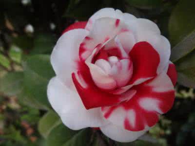 脖子落枕好的快小偏方 一次就好的落枕偏方